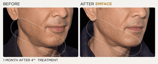 male-chin.jpg