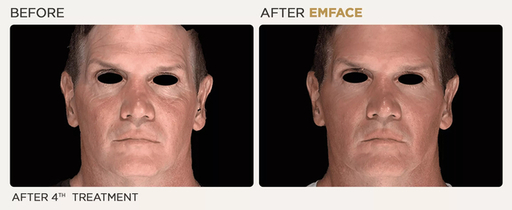 male-face.jpg
