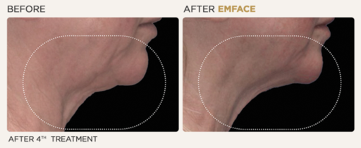 female neck.png